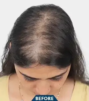 Patient Case 1 before treatment