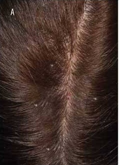 Patient Case 2 before treatment