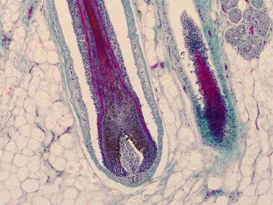 Histological magnification of hair follicle dermal papilla root bulb